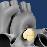 SHDエコーライブ/セッション