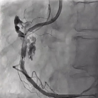 Bailouters/Bailouters Advance