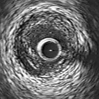 Imaging＆Physiology