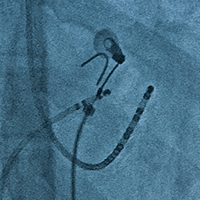 Ablation入門編！この入門編を待ってました